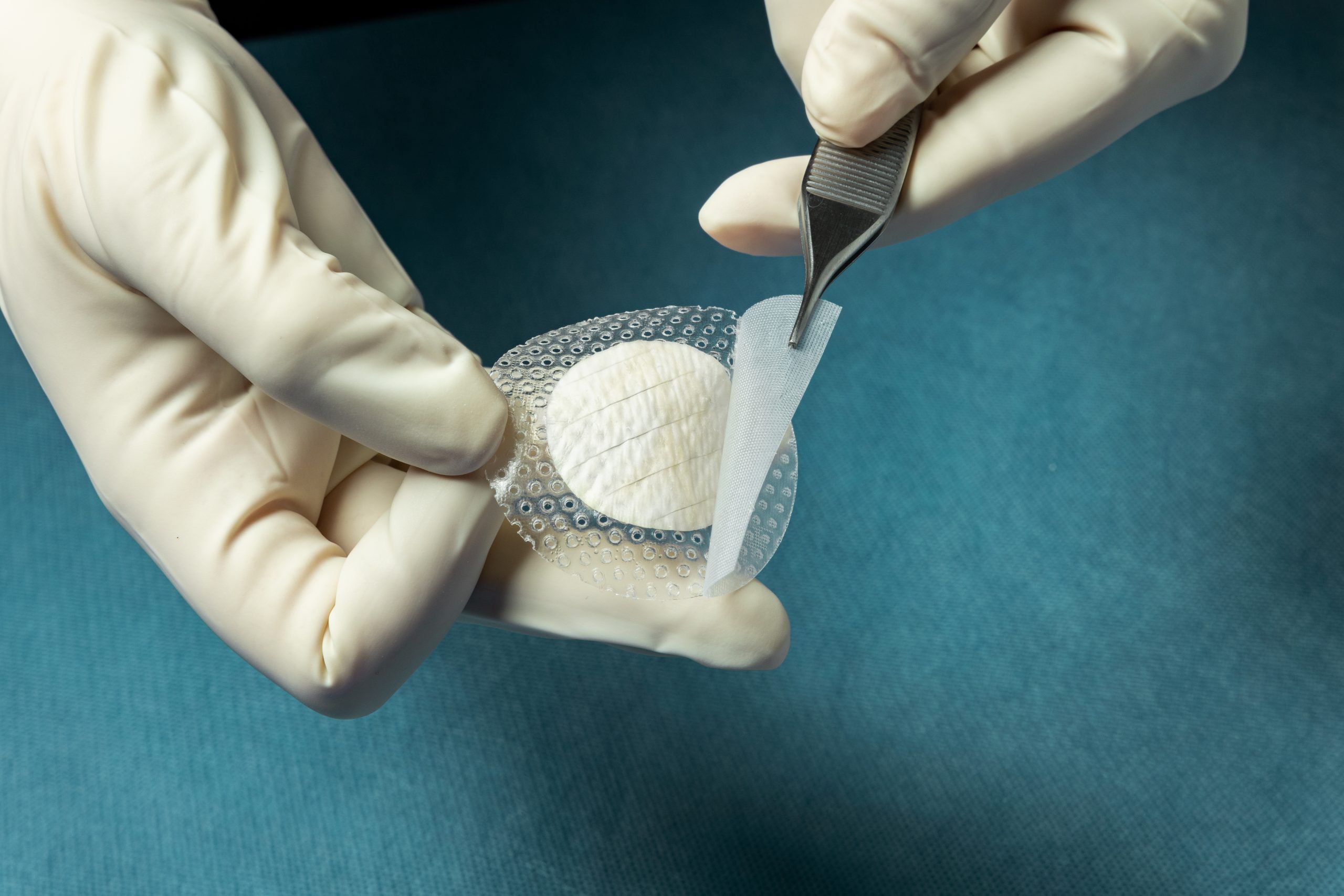 Kerecis Combines Fish-Skin Graft and Silicone Cover for Wound Treatment