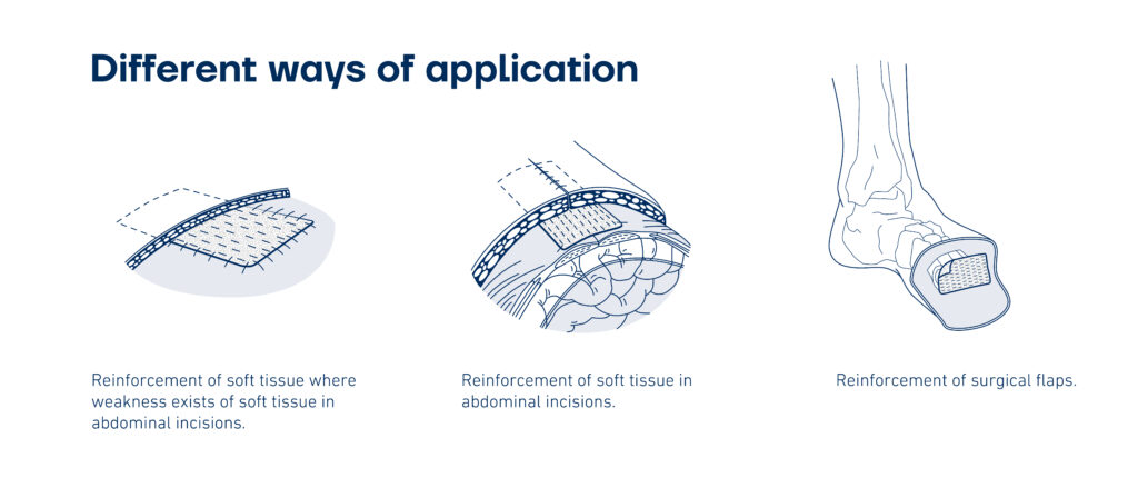 Different ways of application